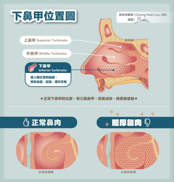 孕妇感冒鼻塞怎么办？缓解鼻塞的实用方法及注意事项