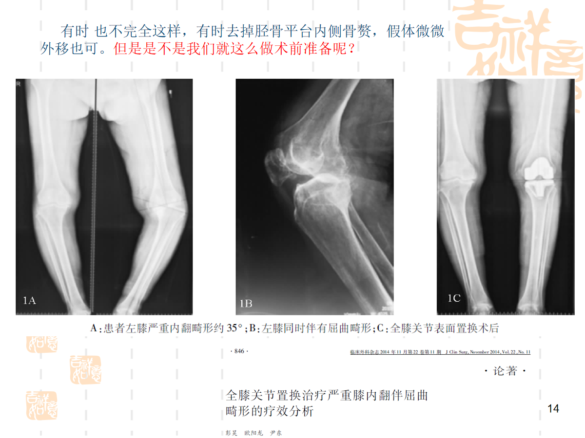 膝盖发黑别慌！深度解析膝盖黑怎么办及改善方法