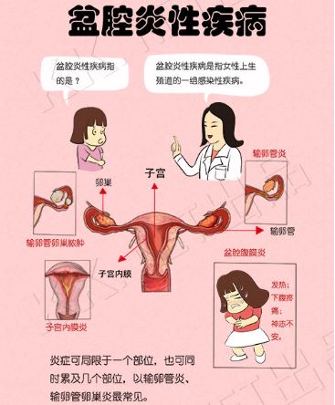 盆腔炎是怎么引起的？探究病因及预防措施