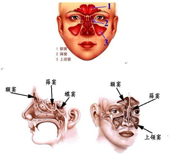 蝶窦炎是怎么回事？深度解析蝶窦炎的症状、病因、治疗及预防