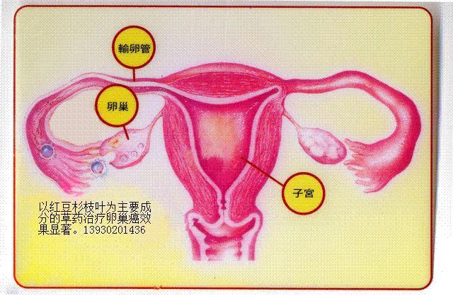 畸胎瘤是怎么回事？详解成因、类型、诊断与治疗