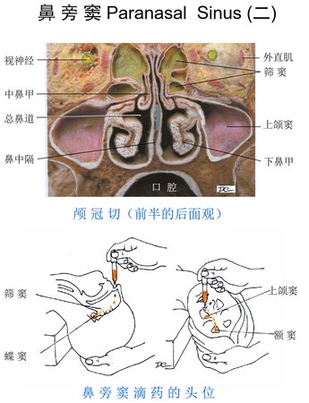 鼻窦炎是怎么引起的？探究病因、症状及预防策略