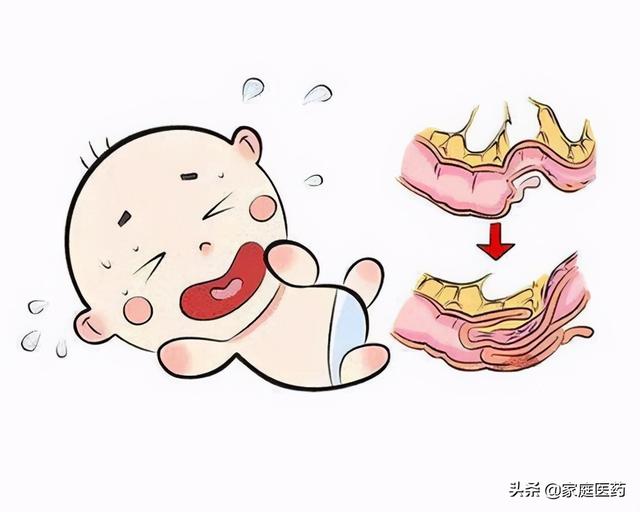 便血怎么回事？详解便血原因、症状及应对策略