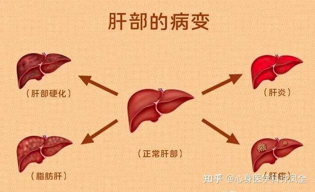 怎么调理肝胆：从饮食、运动到情绪管理的全方位指南