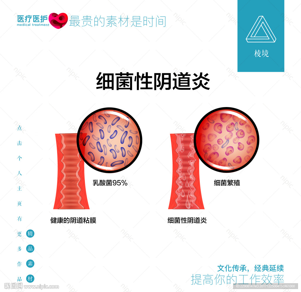 阴道炎怎么治疗：各类阴道炎的治疗方法及防治知识