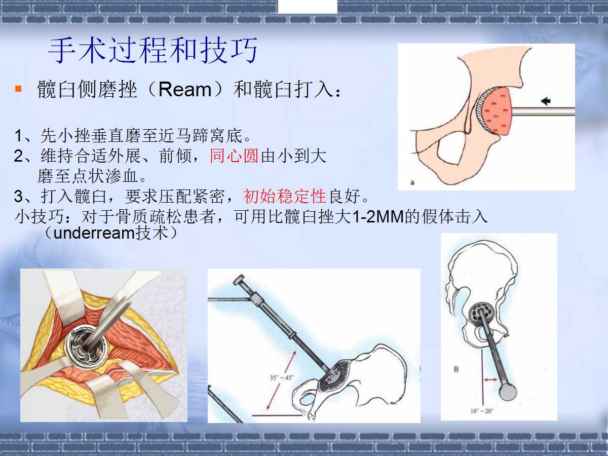 关节炎怎么治？深度解析各种治疗方法及潜在风险