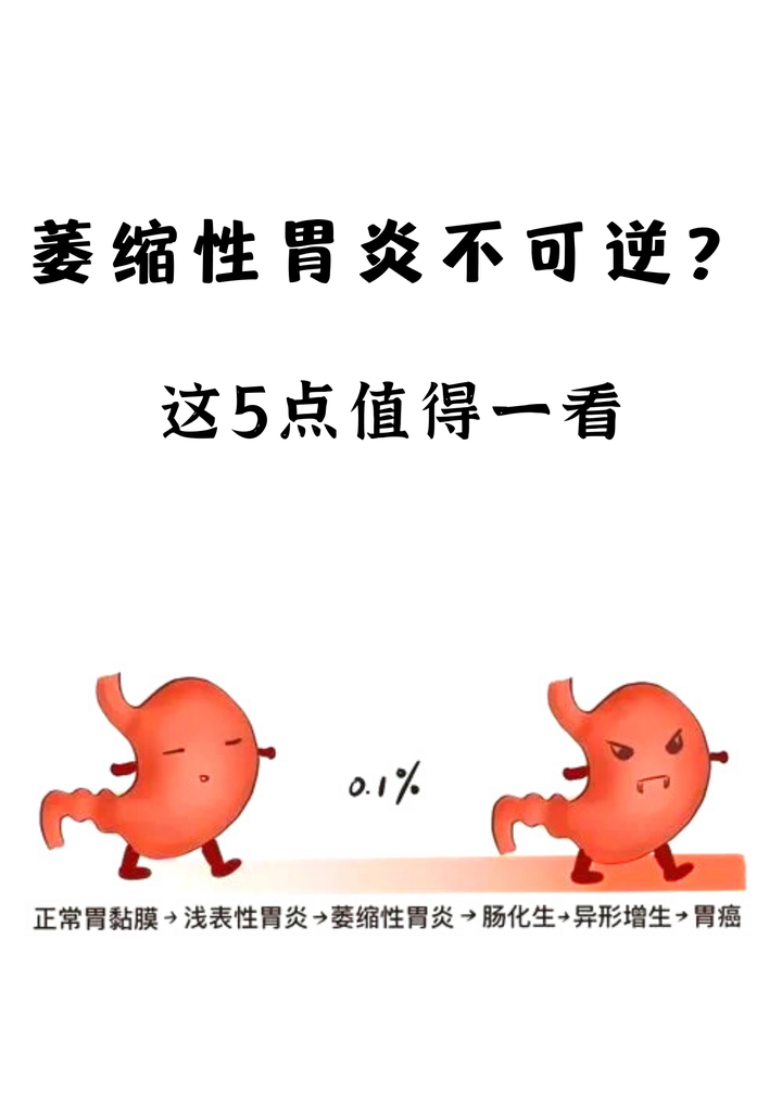 萎缩性胃炎是怎么引起的？探秘幽门螺杆菌感染及其他致病因素