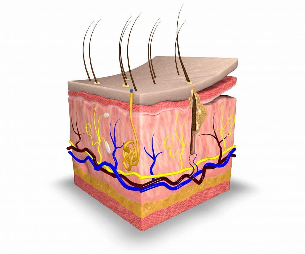 长肉疙瘩小肉粒是怎么回事？皮肤赘生物的成因、类型及应对策略