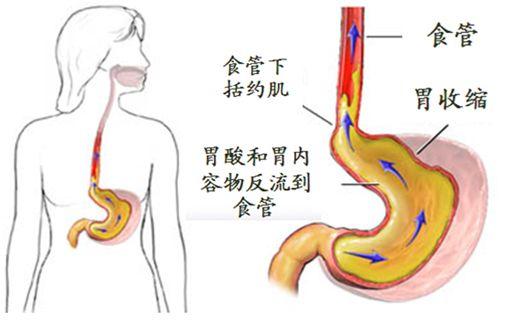 心闷、胸口堵、难受是怎么回事？深度解析及应对策略