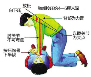 被呛到怎么办？实用急救指南及预防措施详解