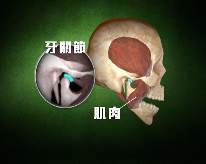 怎么治疗牙疼？缓解牙痛的实用方法及专业建议